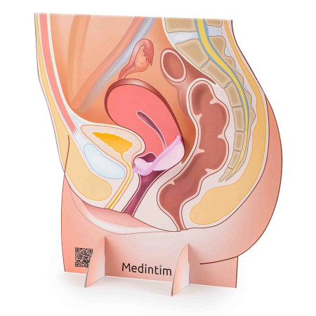 représentation de l'appareil génital féminin avec diaphragme à louer