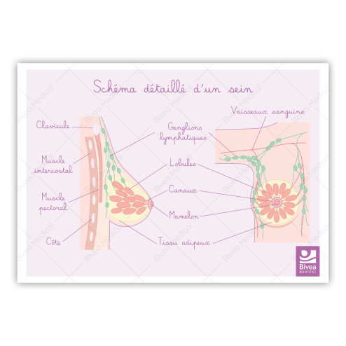 Schéma détaillé d'un cancer du sein