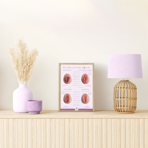 poster différentes formes de vulves en A4
