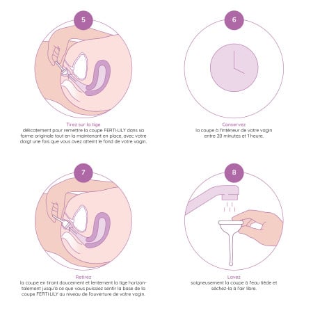 Comment utiliser la coupe de conception FERTILILY