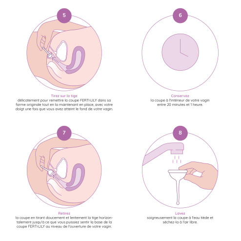Comment utiliser la coupe de conception FERTILILY