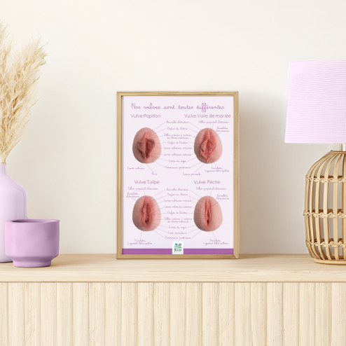 poster différentes formes de vulves en A4