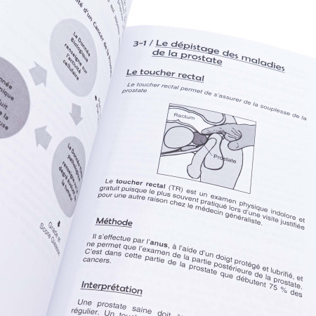 Cancer de la prostate : comprendre, anticiper, guérir