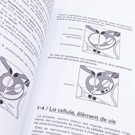 Cancer de la prostate : comprendre, anticiper, guérir