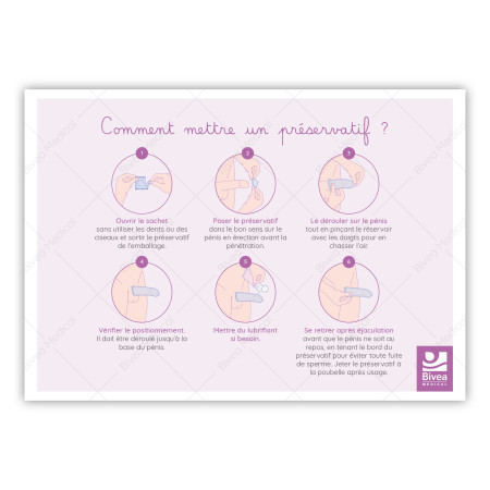 Illustration utilisation du préservatif par étapes