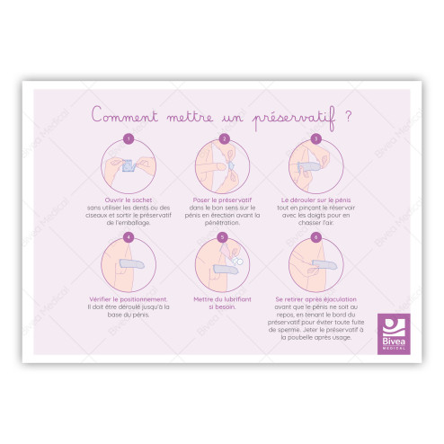 Illustration utilisation du préservatif par étapes