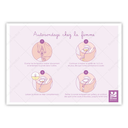 Illustration Autosondage chez la femme sur fond blanc
