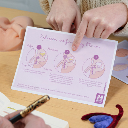 schéma utilisation sphincter artificiel chez l'homme et la femme