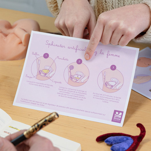 schéma utilisation sphincter artificiel chez la femme dans la main