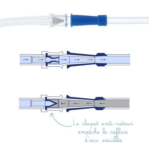 clapet anti-retour reprop basic