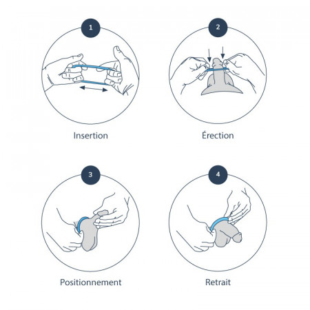 Anneau pénien Erectionrings de Medintim, Lot de 3