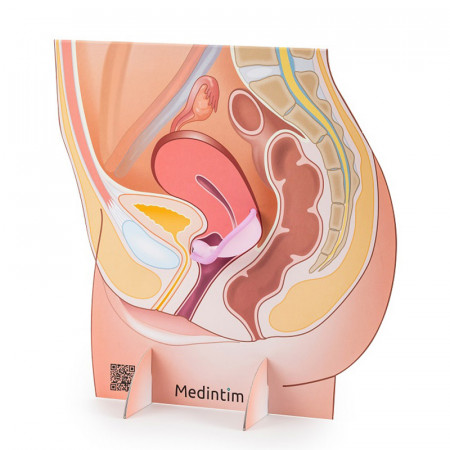 Représentation de l'appareil génital féminin avec un diaphragme en carton