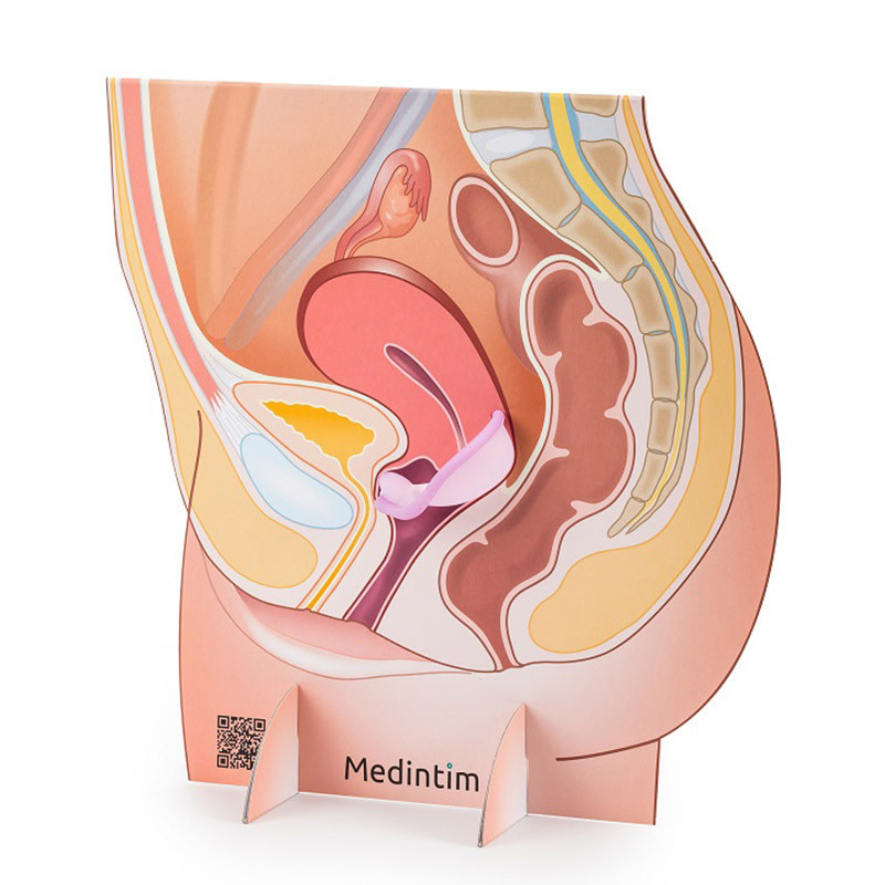 Caractéristiques du diaphragme contraceptif à différentes tailles Medintim