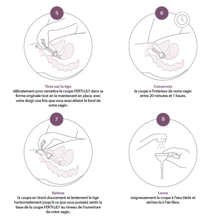 Comment utiliser la coupe de conception FERTILILY