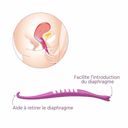 Applicateur pour diaphragme medintim légendes