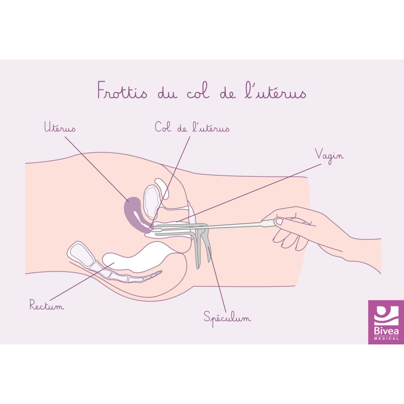 schéma anatomique frottis du col de l'utérus