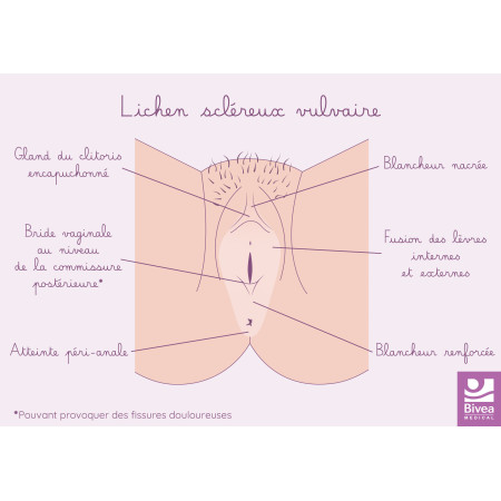 schéma lichen scléreux vulvaire