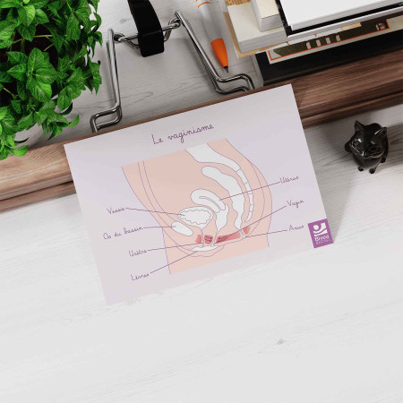 carte anatomique vaginisme sur bureau