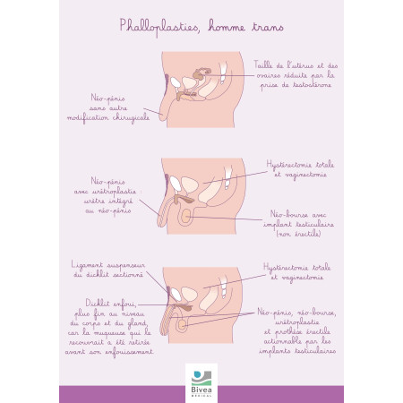 Poster A4 Phalloplasties homme trans