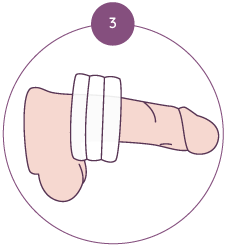 Étape 3 : placer et ajuster les anneaux Bumpi