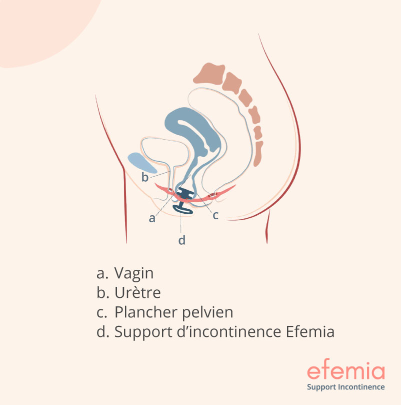 Efemia_Bladder_Support_utilisation.jpg