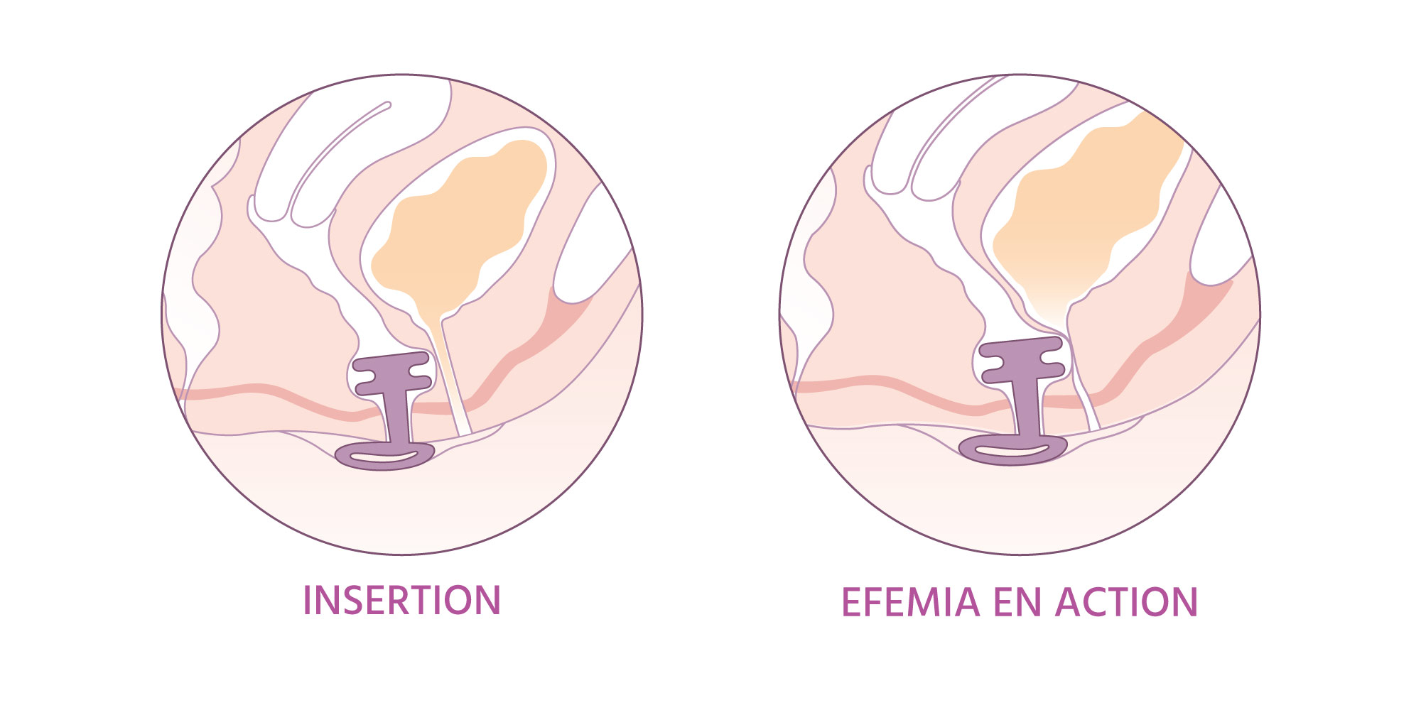 efemia en action