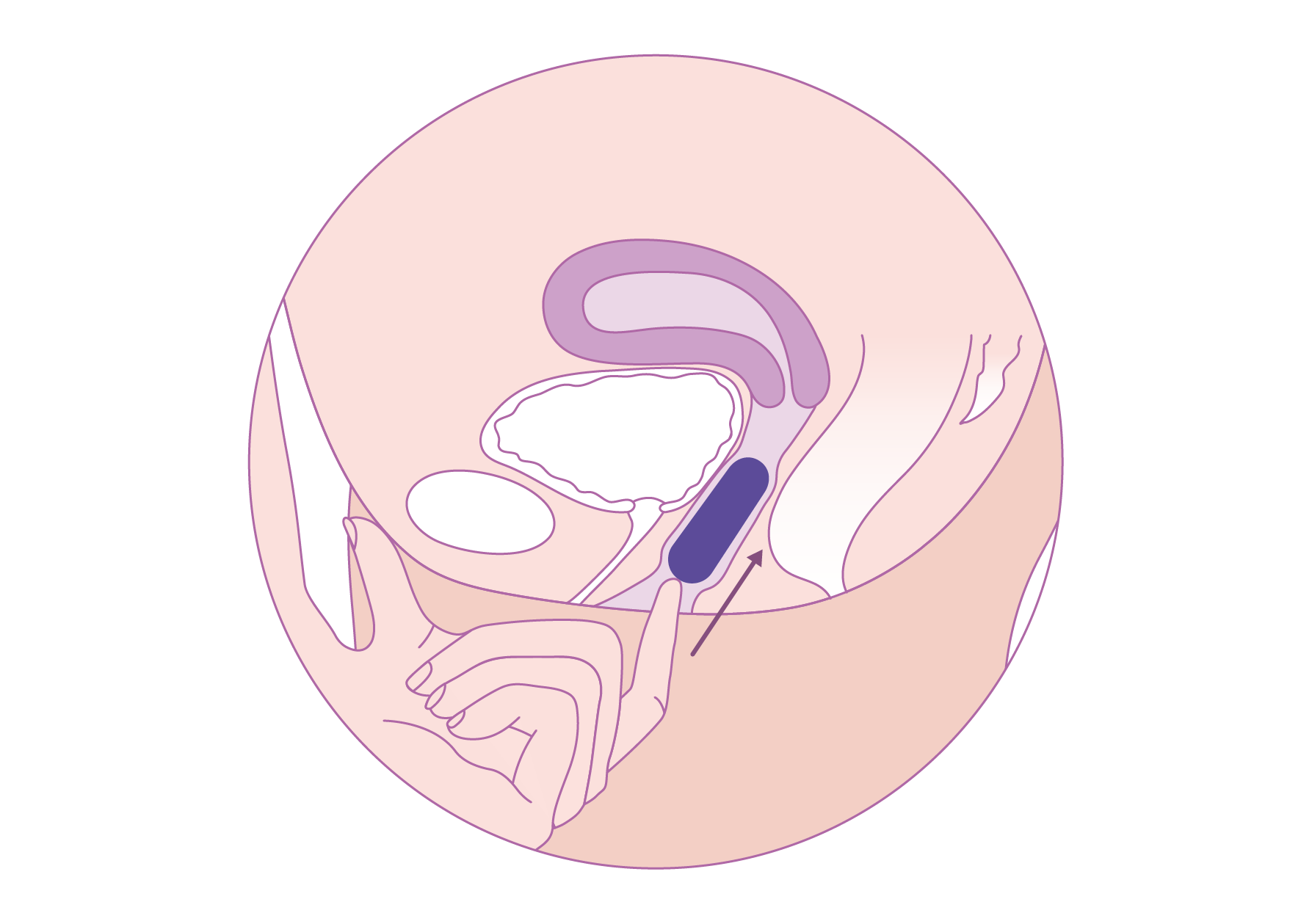 Trackle - placement.png