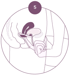 Vérifiez avec un doigt que le col de l'utérus est recouvert par la membrane du diaphragme. Il faut pouvoir sentir le col.